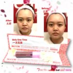 5D SLIMFACE & SCULPTING -TRTSET - 神奇瘦脸 挺致-全方位 微型美疗膜-22gm