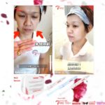 3 IN 1 THERMA LIGHTENING ESSENCE 微医美嫩白精华液 -10ML*3