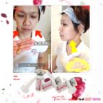 5 IN 1 FACE LIFT SLIM & CONTOURING SERUM 5in1微医紧致纤容抗菌精华液-10ML*3