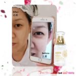 HYALURONIC RESTORATIVE EYE & SKIN LOTION -恢复保湿舒緩亮丽眼.肤露-50ML / 100ML