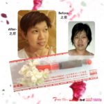 7DS JAWline SMALL V AESTHETICS MASK-小弧下颌提升微型美膜-8GM