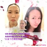 7D-SHARP CHIN(H15) AESTHETICS MASK- 立显下巴微型美膜-2GM