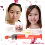 7D-UPPER LIPFILL(H29) & LIP BEAD AESTHETICS MASK-微填上唇肌 ,立唇珠,唇型微医美膜-2GM