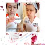 6 IN 1 ADVANCED AESTHETICS  ESSENCE 微医美拉提美白精华液-10ML*3