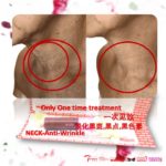 1of5-Anti-Saggy neck, ostrich,excess,wrinkle Neck-预防 鸵鸟,赘肉,下垂,脂肪,皱纹脖子-一次就见效-大优惠